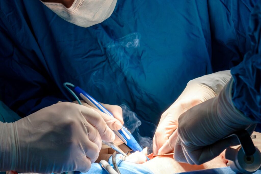 Surgical Smoke